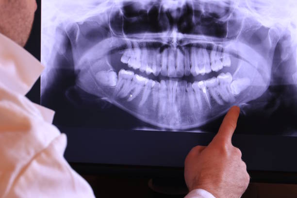 Best Chipped Tooth Repair Near Me  in East Cleveland, OH