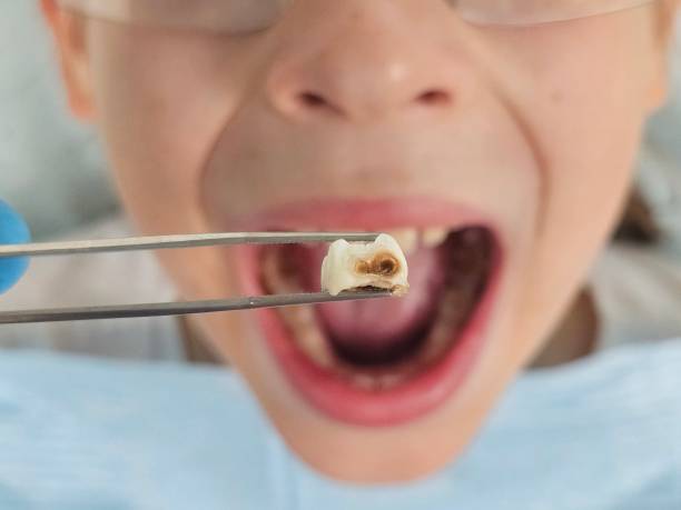 Best Knocked-Out Tooth Emergency  in East Cleveland, OH