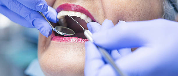 Best Dentist Open Late Near Me  in East Cleveland, OH